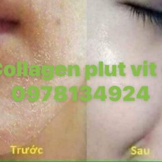 Kem Collagen plus vit e