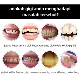 Răng giả niềng răng chất lượng cao