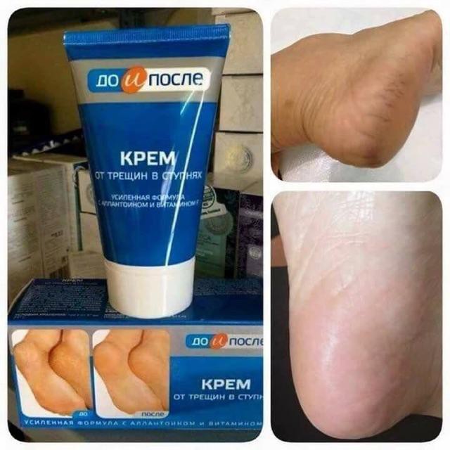 Kem Nứt Gót Chân Kpem Apteka Của Nga - 50ml