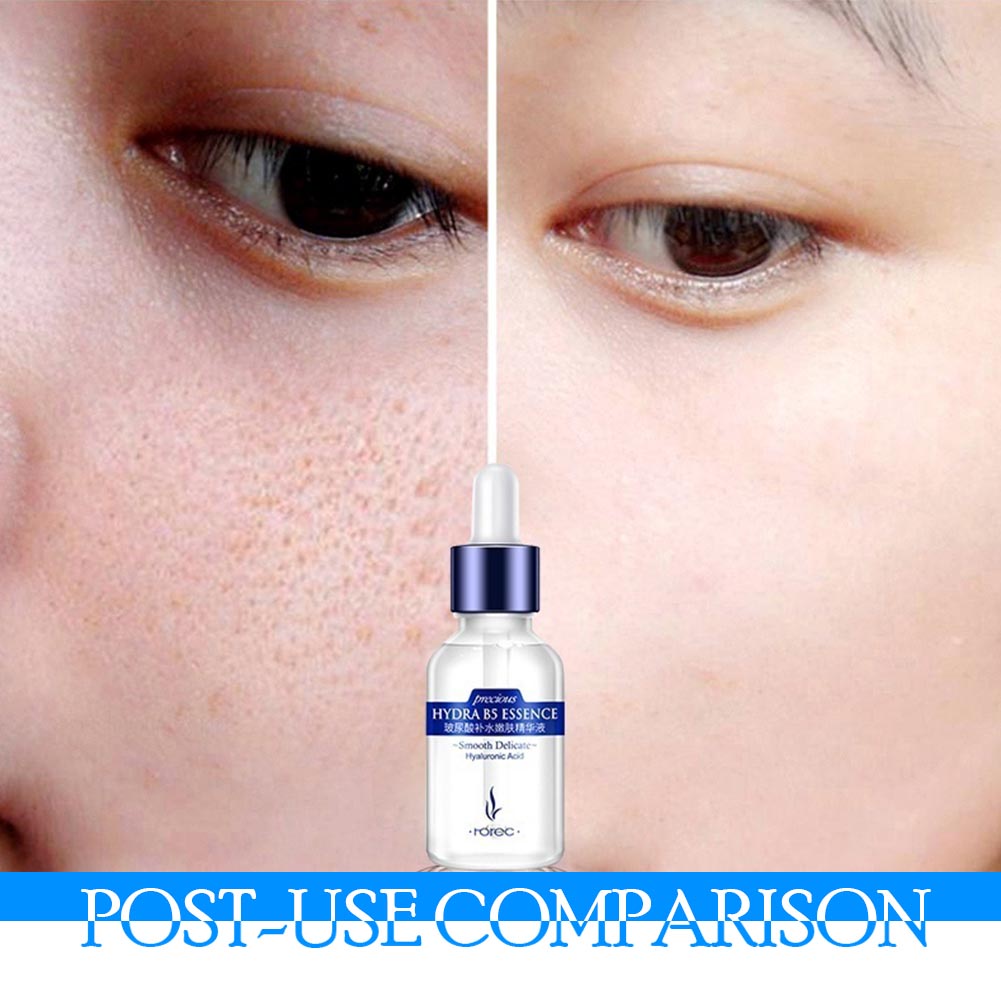 (Hàng Mới Về) Tinh Chất Axit Hyaluronic Giúp Nâng Cơ Mặt Và Chống Lão Hóa Hiệu Quả | BigBuy360 - bigbuy360.vn