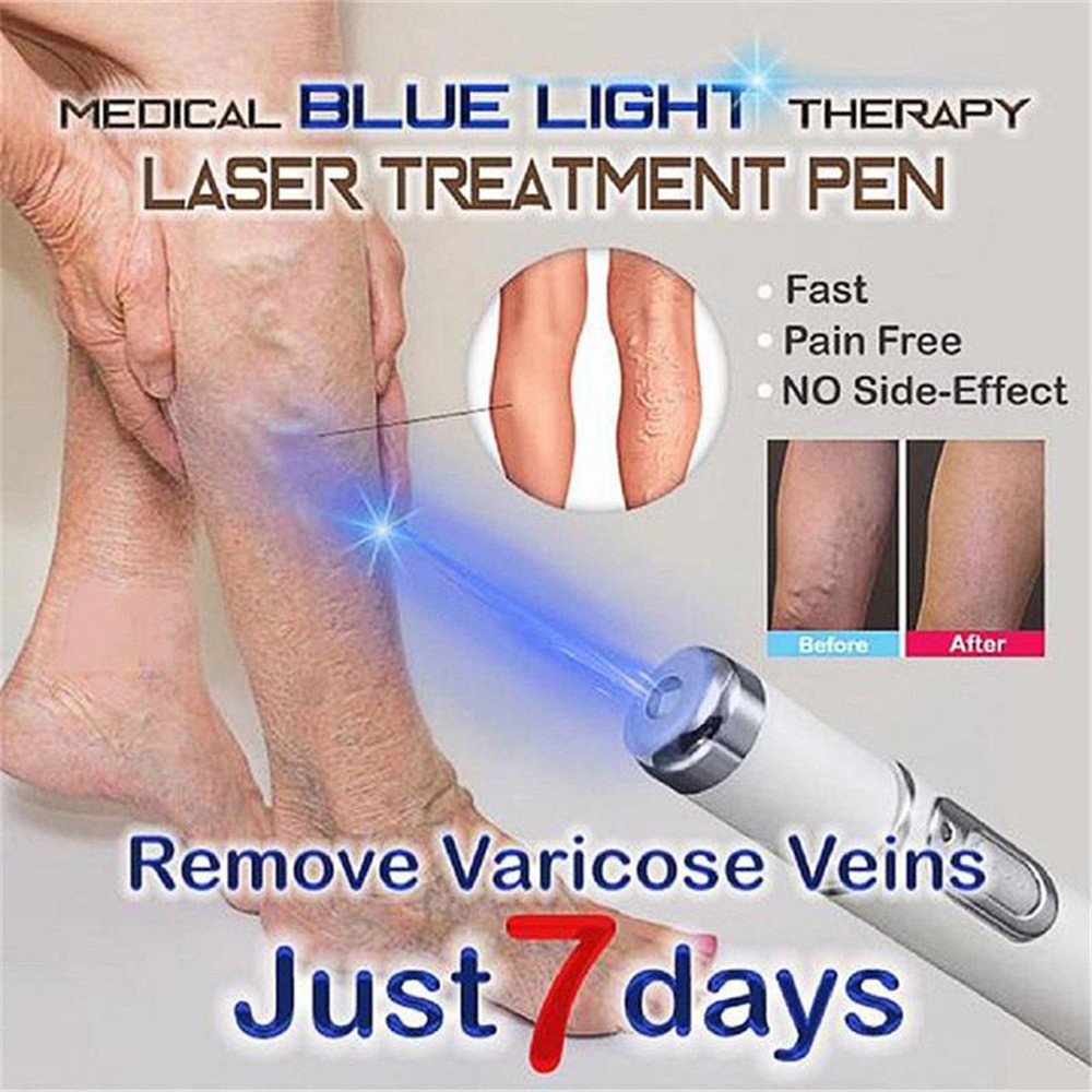 Bút Xóa Sẹo Bằng Tia Laser Ánh Sáng Xanh Mềm Mại Giúp Thư Giãn KD-7910