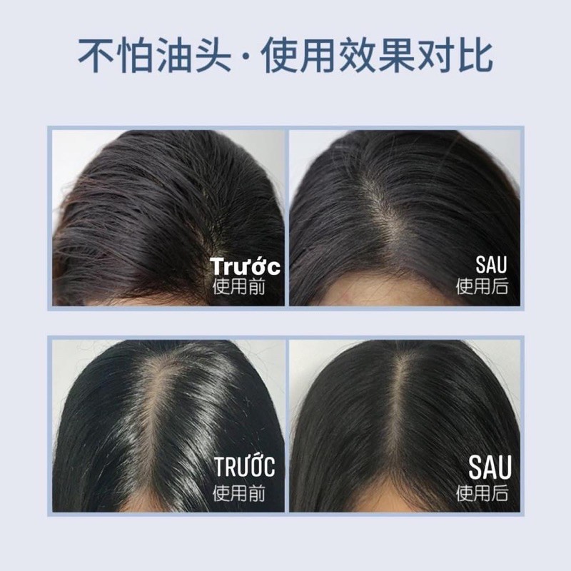 Dầu gội khô ISSY - Liyeclothes | BigBuy360 - bigbuy360.vn