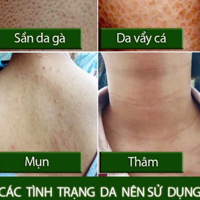 SHINEO | Tẩy Tế Bào Chết Sáng Mịn Toàn Thân Vỏ Hạnh Nhân