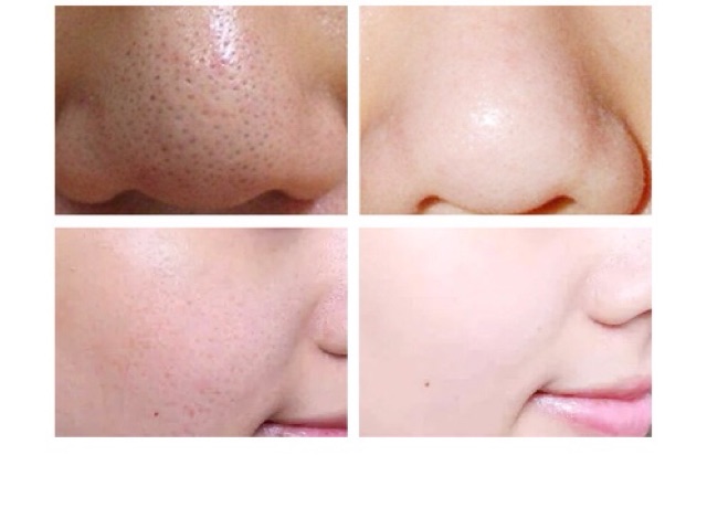 Serum xanh se lỗ chân lông cấp nước cho da