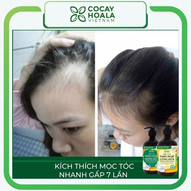 Dầu gội thảo dược thiên nhiên gừng dừa Cỏ Cây Hoa Lá. Làm mềm mượt tóc, giảm rụng tóc, giảm ngứa, 440gr/chai