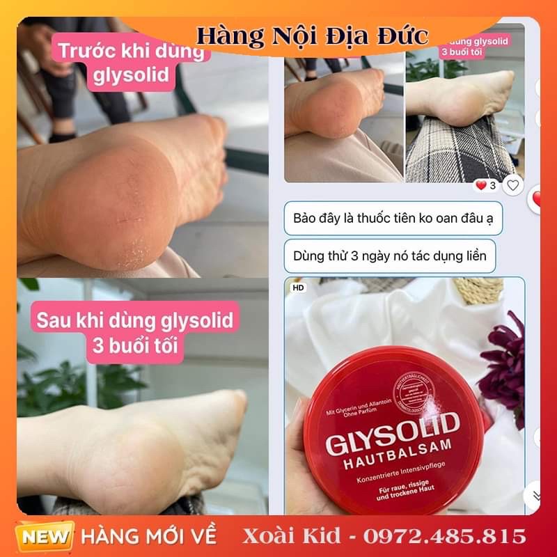 [Hàng nội địa Đức] Kem nẻ Glysolid giúp dưỡng ẩm tay, chân