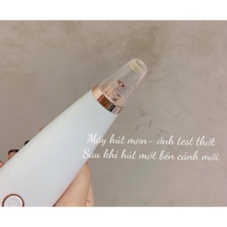 Máy hút mụn bã nhờn