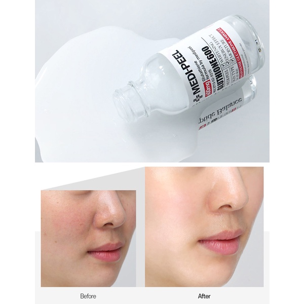 Combo Dưỡng Trắng MEDI PEEL Glutathione 600 White Truyền Trắng Da MEDI PEEL