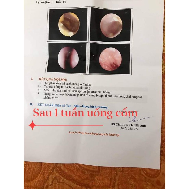 Cốm VIMITAI Viên Minh