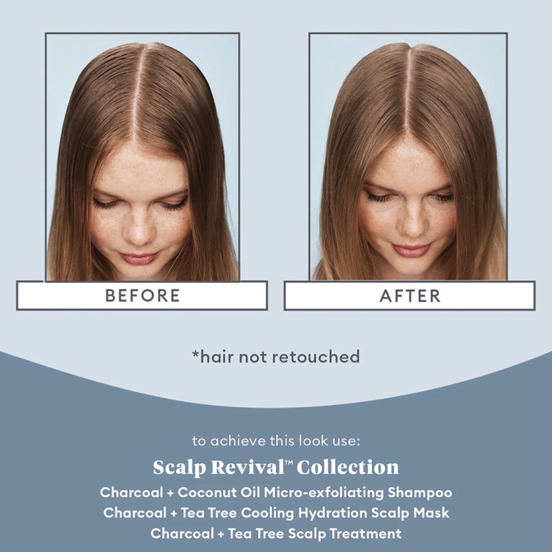 Tinh chất giảm ngứa da đầu Briogeo Scalp Revival Charcoal + Tea Tree Scalp Treatment Serum