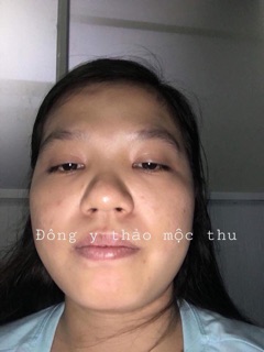 Đông Y Thảo Mộc Thu