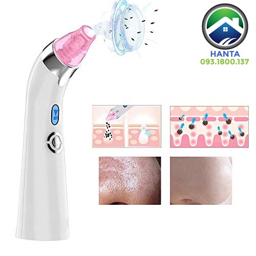 Free Ship 🎁🎁🎁 [CHÍNH HÃNG COMEDO] [BẢO HÀNH 12 THÁNG] MÁY HÚT MỤN COMEDO SIÊU MẠNH HÀN QUỐC 2020 - BẢO HÀNH 12 THÁNG | BigBuy360 - bigbuy360.vn