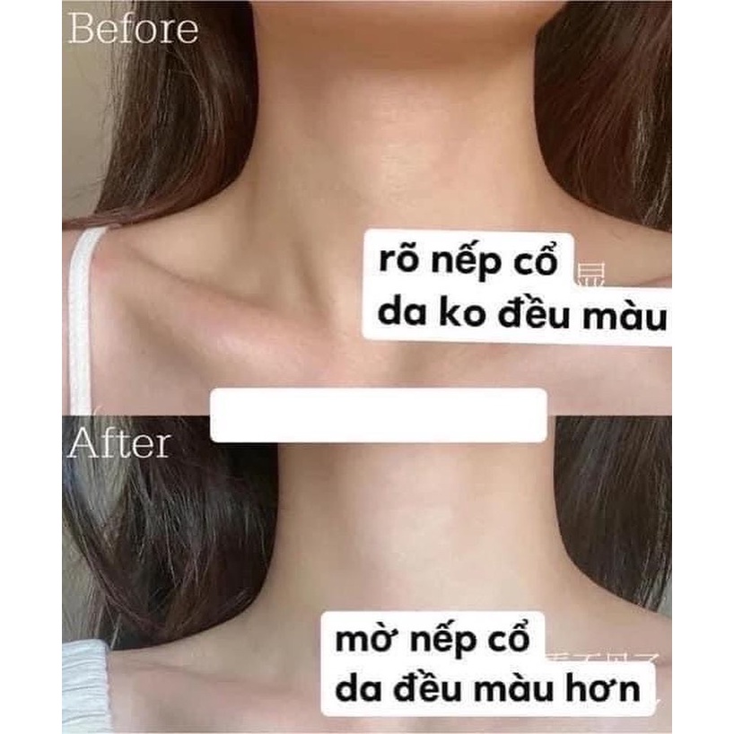 KEM DƯỠNG CỔ VÀ NGỰC GOLD BOND ULTIMATE NECK & CHEST FIRMING CREAM