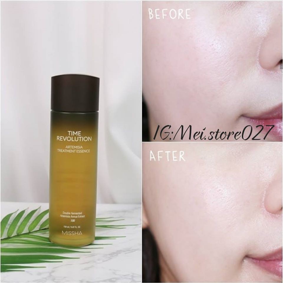 Nước thần Missha Time Revolution Artemisia Treatment Esence 100ml