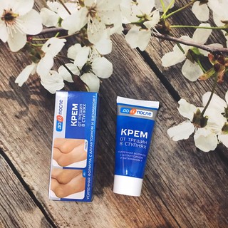 Kem trị nứt gót chân Kpem