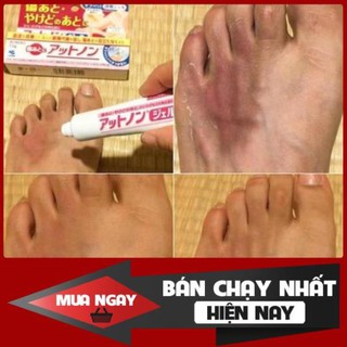 [⭐Hàng Mớiii⭐] Kem Trị Sẹo "Thần Thánh" Kobayashi 15g
