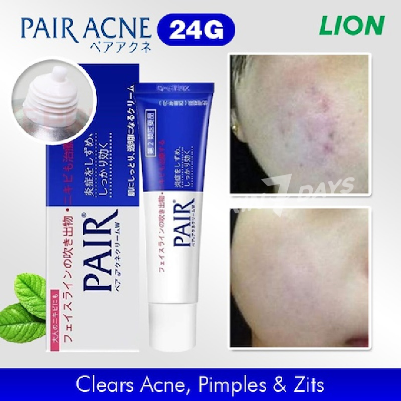 Kem Cải Thiện Mụn LION PAIR ACNE Kem Hỗ Trợ Giảm Mụn / Sữa Rửa Mặt Tạo Bọt Hỗ Trợ Giảm Mụn Dạng Kem Hiệu