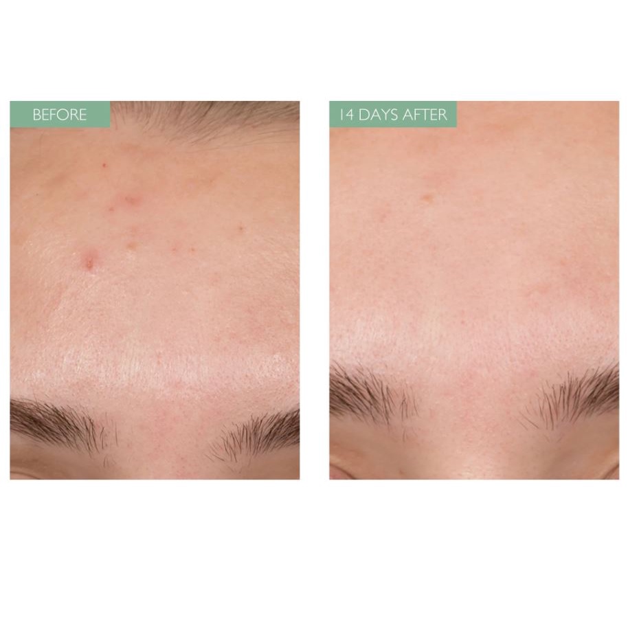 Kem Dưỡng Ẩm Caudalie Vinopure Moisturizing Mattifying Fluid 40ml