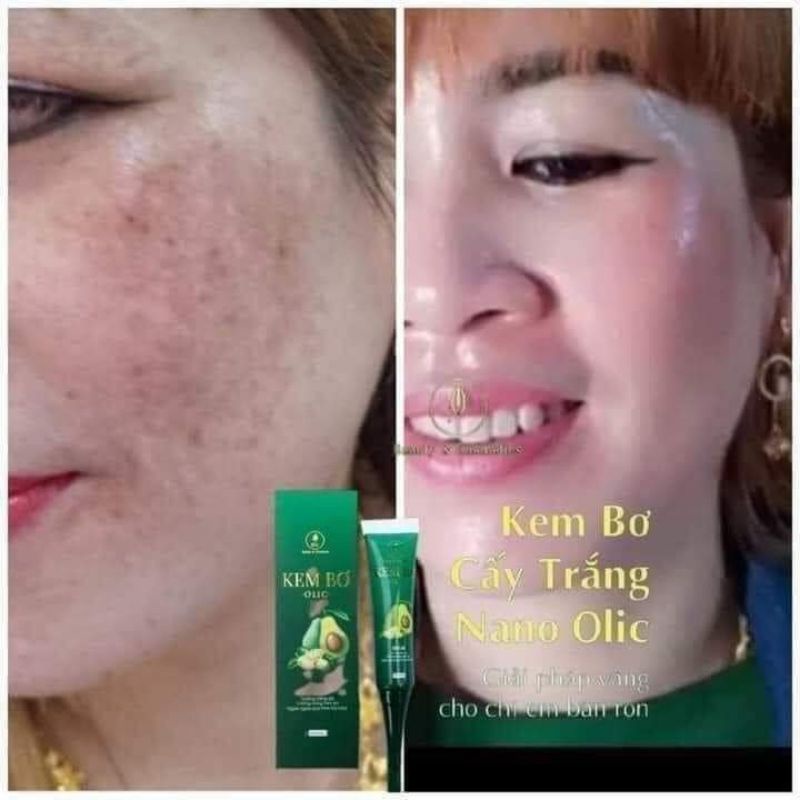 COMBO 5 KEM BƠ NANO OLIC + TẶNG BODY BIA + SỮA RỬA MẶT
