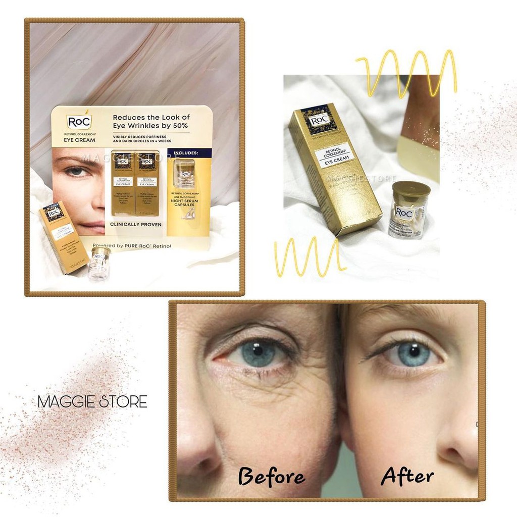 KEM MẮT ROC RETINOL EYE CREAM - 15ML | BigBuy360 - bigbuy360.vn