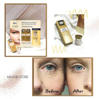 KEM MẮT ROC RETINOL EYE CREAM - 15ML