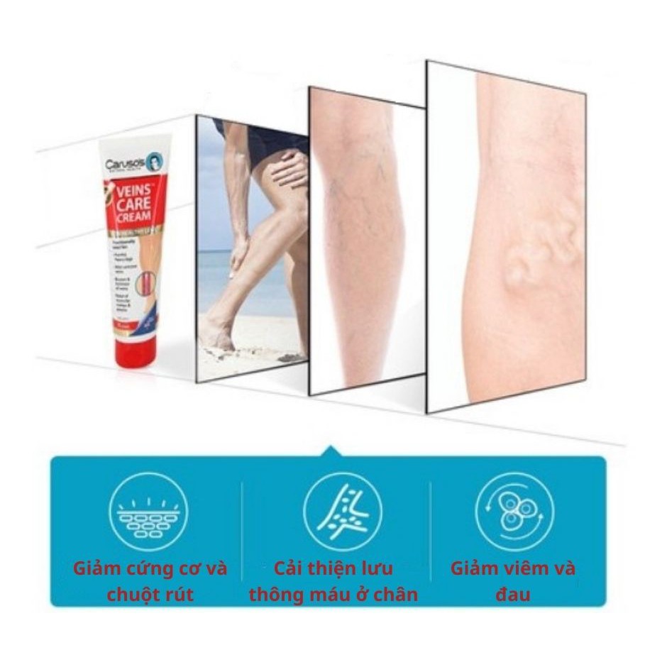 Kem dưỡng cho người suy giãn tĩnh mạch Carusos Veins Care Cream 75g