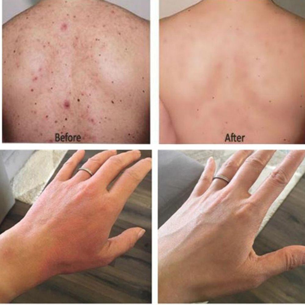 ROSE Xà Phòng Gỗ Đàn Hương Làm Trắng Da Chống Vi Khuẩn