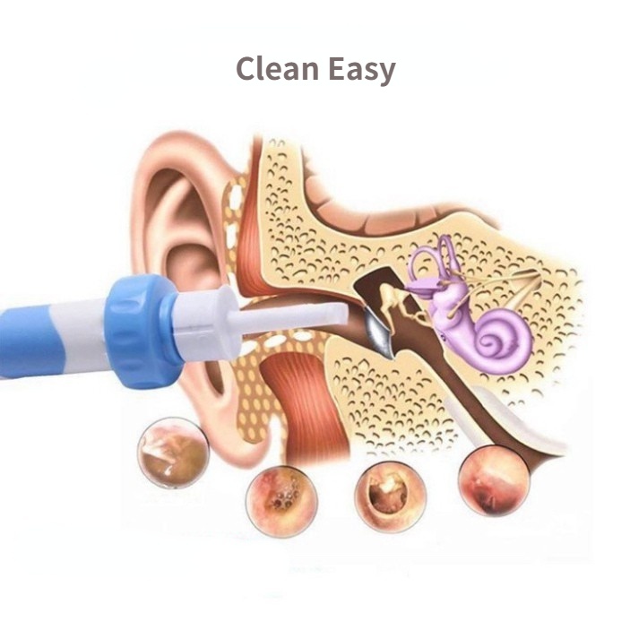 Máy hút vệ sinh ráy tai dạng xoắn ốc sử dụng điện an toàn tiện dụng