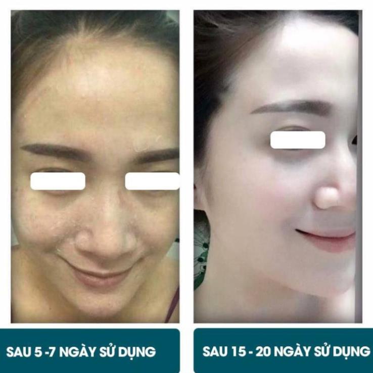 Thay Da Sinh Học HERBAL PEEL-Behome Spa - Công Nghệ Nhật Bản 👉Freeship 👉Tái Sinh Làn Da, Kem tái tạo da | BigBuy360 - bigbuy360.vn