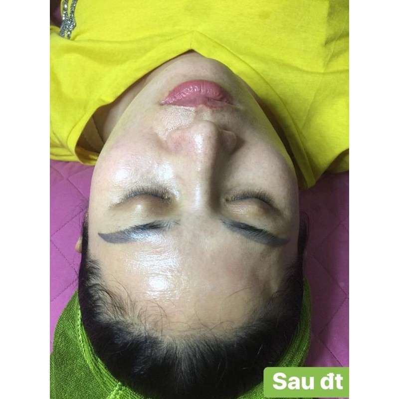 1 HỘP KEM KONE THÁI LAN CHÍNH HÃNG | BigBuy360 - bigbuy360.vn