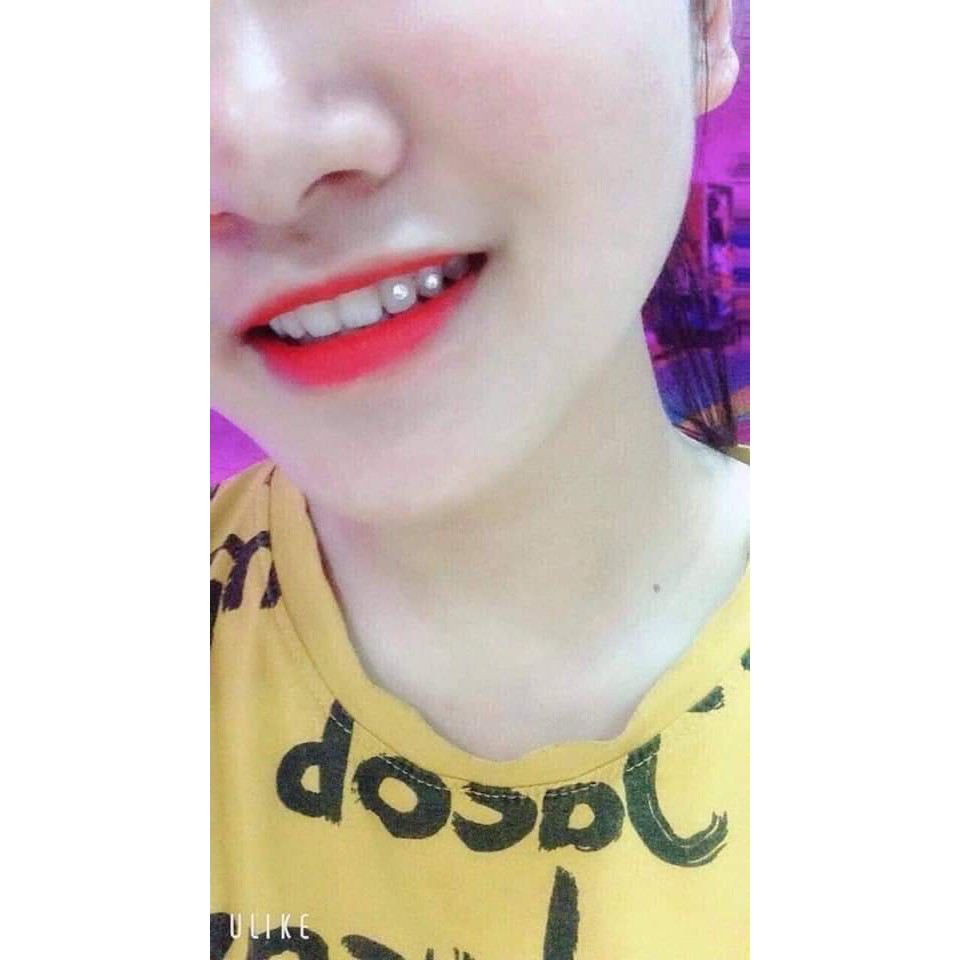 Đá đính răng Vỉ Úc 5 viên chân nhọn và chân bằng