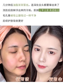 Mặt nạ đất sét