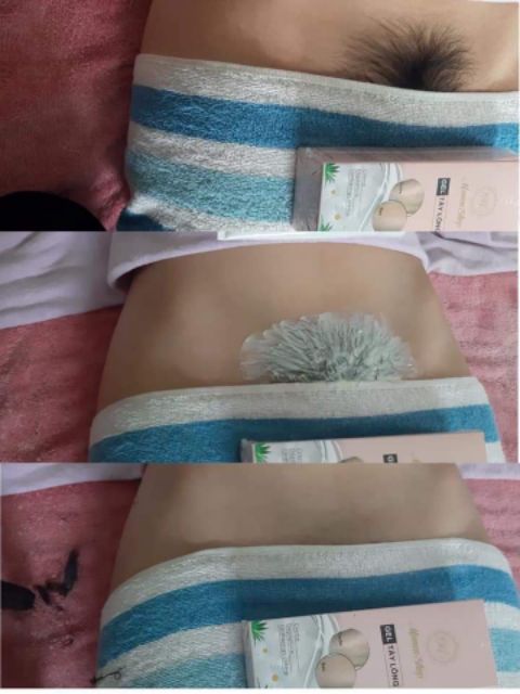 Kem triệt lông râu tận gốc vĩnh viễn thảo dược