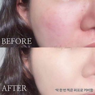 (1 miếng lẻ) Mặt nạ Derm All Matrix
