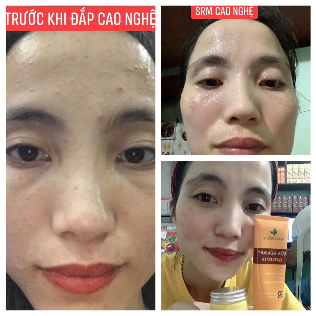 Sữa Rửa Mặt GoldPlus Thảo Mộc 37 Chính Hãng | BigBuy360 - bigbuy360.vn