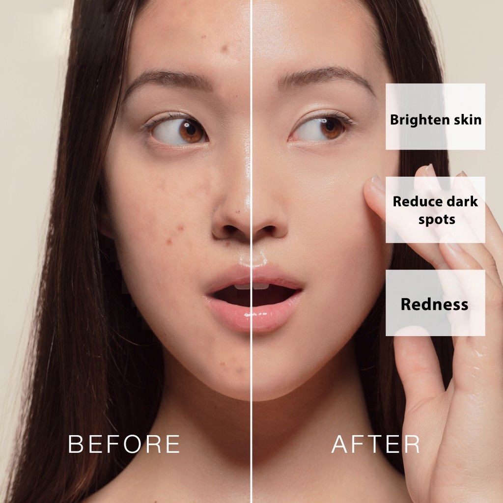 Serum dưỡng da SUMAX chứa Niacinamide Axit Hyaluronic B5 Alpha Arbutin Caffeine Lactic Acid Retinol 30ml hiệu quả