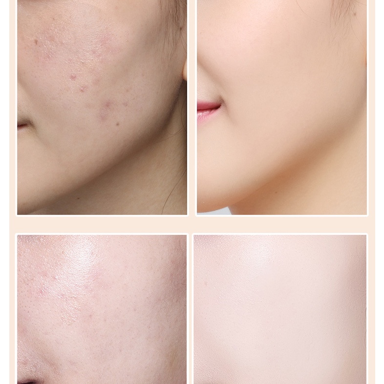 Kem Nền BB Che Khuyết Điểm Làm Sáng Da Che Mụn Và Đốm Đen