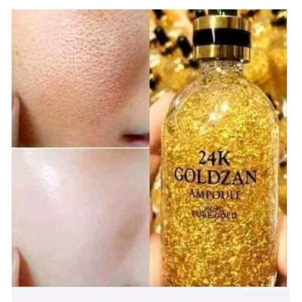 (Hàng Mới Về) Tinh Chất Vàng 24k Goldzan Chống Lão Hóa Cao Cấp