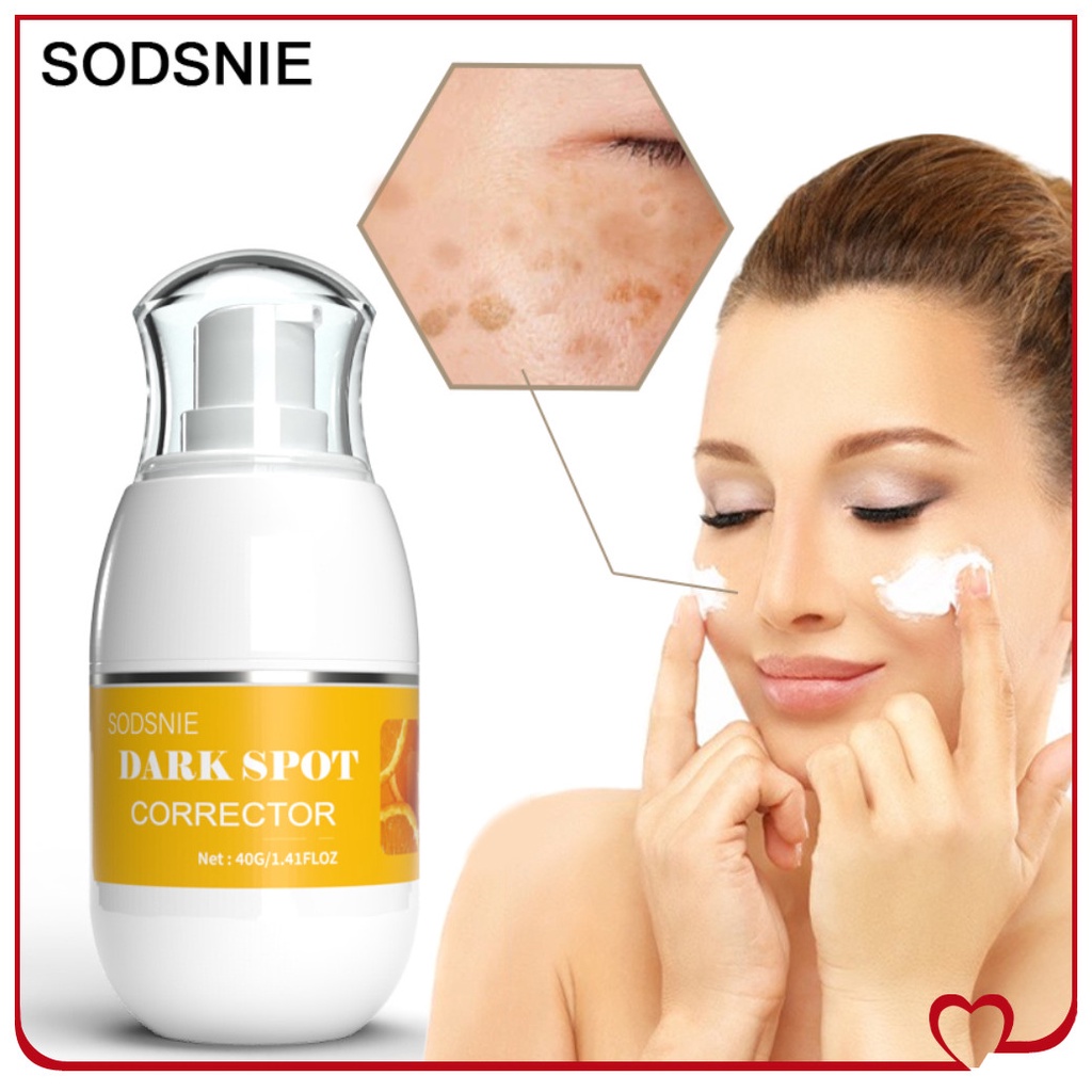 Sodsnie 40G Làm Trắng Da Tàn Nhang Kem Loại Bỏ Nám Vết Đen Làm Sáng Hắc Tố Melanin Làm Sáng Da Trị Nám Tẩy Trang Dưỡng Ẩm Chăm Sóc Da Mặt
