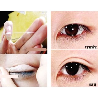 Chỉ tạo mắt 2 mí siêu tự nhiên