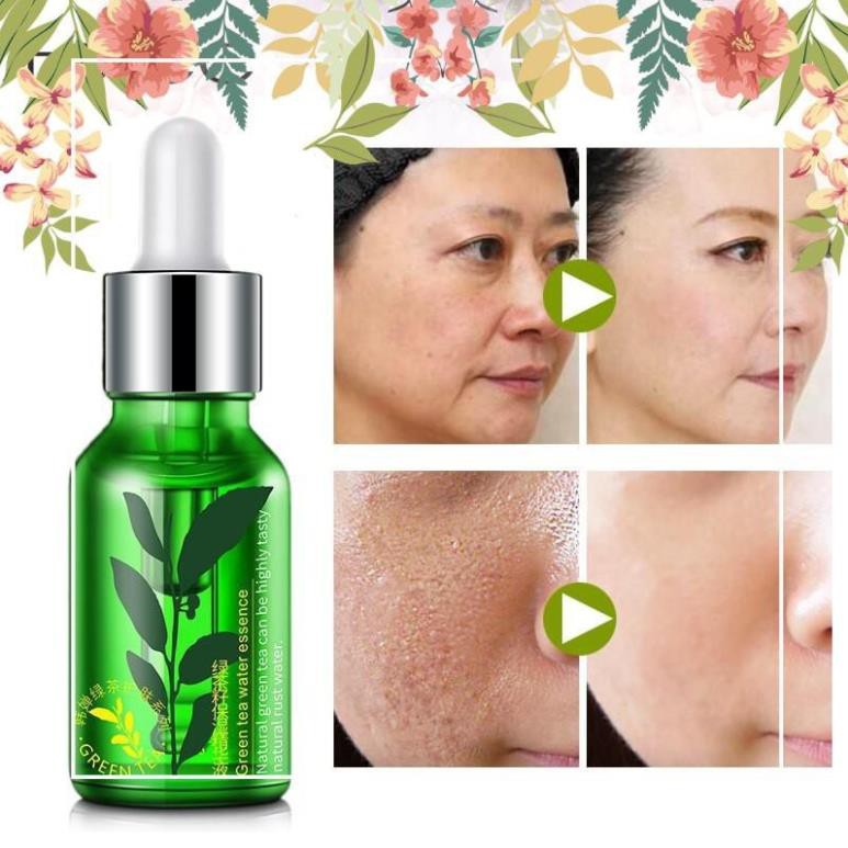 [Mua 2 Miễn Phí Vận Chuyển]Serum Trà Xanh Chăm Sóc Da Làm Trắng và Chống Lão Hóa Rorec 15ml