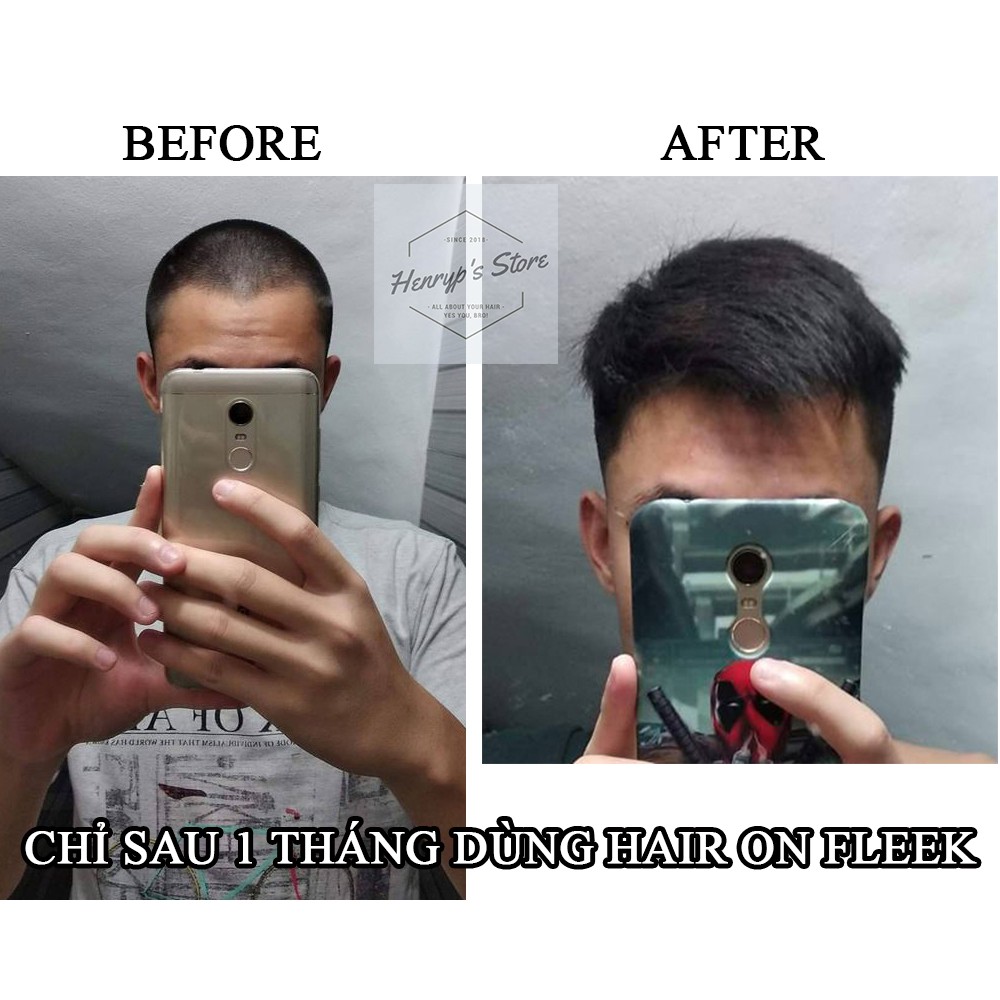 SIÊU DƯỠNG TÓC HAIR ON FLEEK | BigBuy360 - bigbuy360.vn