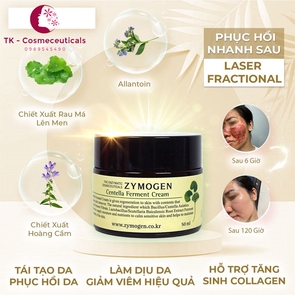 Kem Dưỡng Da Rau Má Zymogen Ngừa Mụn, Tái Tạo Da, Mờ Thâm, Lành Sẹo - 50ml