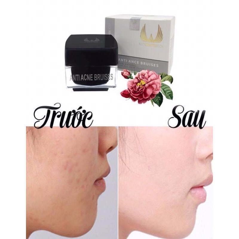 KEM DƯỠNG DA MẶT ĐA CHỨC NĂNG NÁM VICK WHITE BECK