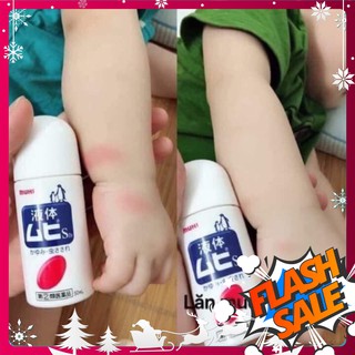 LĂN TRỊ NỐT MUỖI ĐỐT MUHI làm giảm nhanh các con ngứa - NHẬT