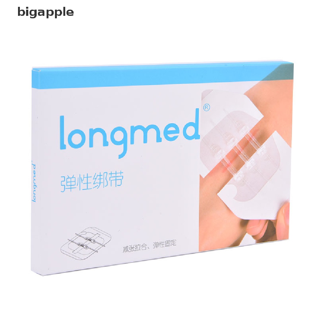 Set 2 băng keo dán vết thương có khóa kéo không cần khoan lỗ