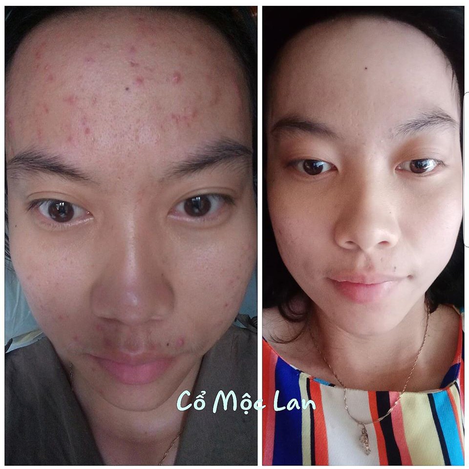Renew skin Dr T Cổ Mộc Lan | BigBuy360 - bigbuy360.vn