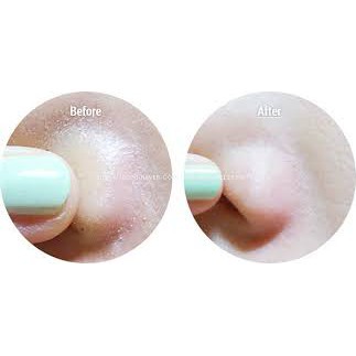 Mặt Nạ Đẩy Mụn Đầu Đen Ciracle Goodbye Blackhead Hiệu Quả, Không Gây Đau Rát