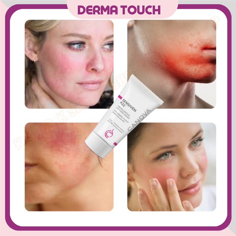 Kem dưỡng Canova Sensiven P22 Soothing Cream 50ml giảm đỏ, dịu da, dành cho da khô nhạy cảm - DMP chính hãng Derma Touch