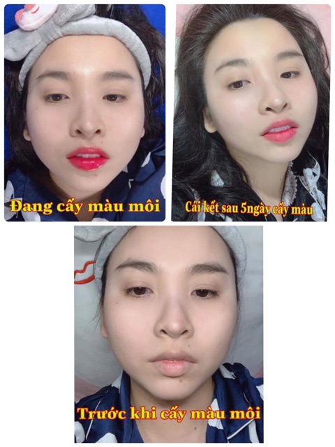 [Mẫu mới]Tinh Chất Cấy Môi Vaura Babier Lips Volume ,mờ thâm làm hồng môi sau 7 ngày | BigBuy360 - bigbuy360.vn